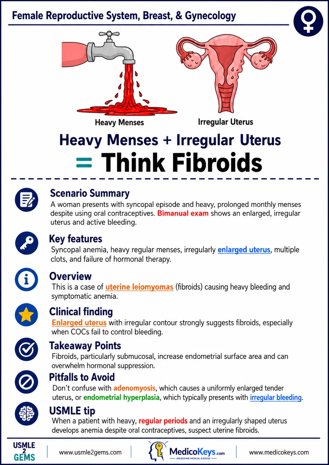 Real USMLE2Gems free sample 16: Think Fibroids — Female Reproductive System, Breast & Gynecology
