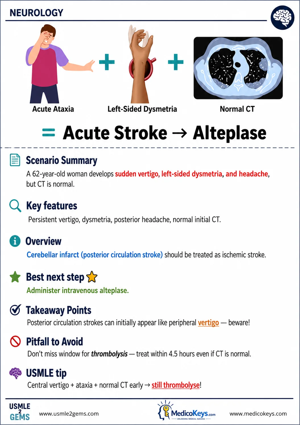 Real USMLE2Gems free sample 4: Acute Ischemic Stroke: Alteplase — Neurology